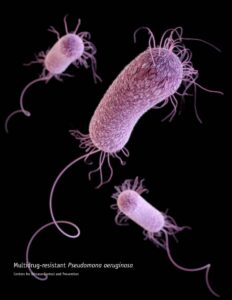 Read more about the article Pseudomonas: THE Emerging Threat in Swimming Pool Diseases
