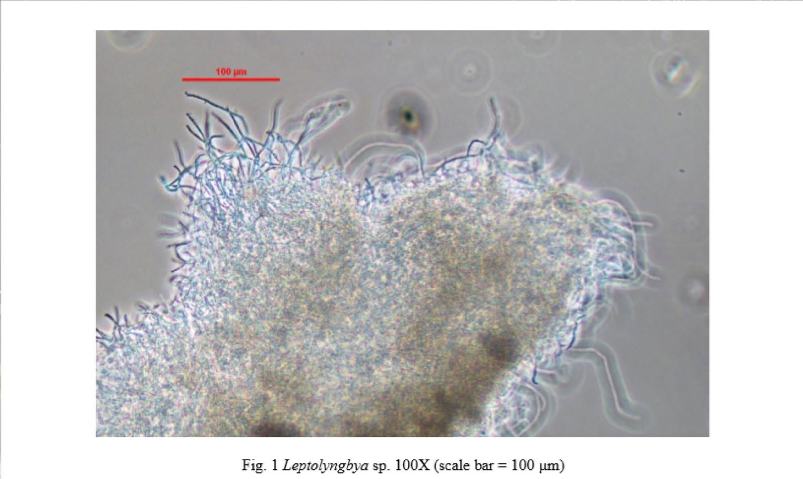 Read more about the article Cyanobacteria-dominated black algae biofilms in three Florida swimming pools